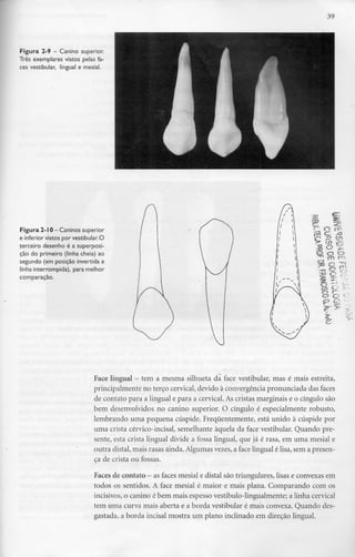 39
Figura 2-9- Canino superior.
Três exemplares vistos pelas fa-
ces vestibular, lingual e mesial.
Figura 2-10- Caninos superior
e inferior vistos por vestibular.O
terceiro desenho é asuperposi-
ção do primeiro (linha cheia) ao
segundo (em posição invertida e
linha interrompida), para melhor
comparação.
Face lingual - tem a mesma silhueta da face vestibular, mas é mais estreita,
principalmente no terço cervical, devido à convergência pronunciada das faces
de contato para a lingual e para a cervical. As cristas marginais e o cíngulo são
bem desenvolvidos no canino superior. O cíngulo é especialmente robusto,
lembrando uma pequena cúspide. Frequentemente, está unido à cúspide por
uma crista cérvico-incisal, semelhante àquela da face vestibular. Quando pre-
sente, esta crista lingual divide a fossa lingual, que já é rasa, em uma mesial e
outra distai, mais rasas ainda. Algumas vezes, a face lingual é lisa, sem apresen-
ça de crista ou fossas.
Faces de contato - as faces mesial e distai são triangulares, lisas e convexas em
todos os sentidos. A face mesial é maior e mais plana. Comparando com os
incisivos, o canino é bem mais espesso vestíbulo-lingualmente; a linhacervical
tem uma curva mais aberta e a borda vestibular é mais convexa. Quando des-
gastada, a borda incisai mostra um plano inclinado em direção lingual.
 