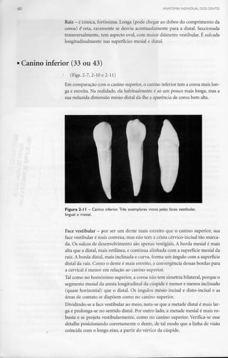 ANATOMIA INDIVIDUAL DOS DENTES
Raiz - é tónica, fortíssima. Longa (pode chegar ao dobro do comprimento da
coroa) ê reta, raramente se desvia acentuadamente para a distai. Seccionada
transversalmente, tem aspecto oval, com maior diâmetro vestibular. É sulcada
longitudinalmente nas superfícies mesial e distai.
• Canino inferior (33 ou 43)
' (Figs. 2-7, 2-10 e 2-11)
Em comparação com o canino superior, o canino inferior tem a coroa mais lon-
ga e estreita. Na realidade, ela habitualmente é só um pouco mais longa, mas a
sua reduzida dimensão mésio-distal dá-lhe a aparência de coroa bem alta.
Figura 2-1 l - Canino inferior. Três exemplares vistos pelas faces vestibular,
lingual e mesial.
Face vestibular - por ser um dente mais estreito que o canino superior, sua
face vestibular é mais convexa, mas não tem a crista cérvico-incisal tão marca-
da. Os sulcos de desenvolvimento são apenas vestigiais.A borda mesial é mais
alta que a distai, mais retilínea, e continua alinhada com a superfície mesial da
raiz. A borda distai, mais inclinada e curva, forma um ângulo com a superfície
distai da raiz. Como o dente é mais estreito, a convergência dessas bordas para
a cervical é menor em relação ao canino superior.
Tal como no homónimo superior, a coroa não tem simetria bilateral, porque o
segmento mesial da aresta longitudinal da cúspide é menor e menos inclinado
(quase horizontal) que o distai. Os ângulos mésio-incisal e disto-incisal e as
áreas de contato se dispõem como no canino superior.
Dividindo-se a face vestibular ao meio, nota-se que a metade distai é mais lar-
ga e prolonga-se no sentido distai. Por outro lado, a metade mesial é mais ro-
busta e se projeta vestibularmente, como no canino superior. Verifica-se esse
detalhe posicionando corretamente o dente, de tal modo que a linha de visão
coincida com o longo eixo, a partir do vértice da cúspide.
 
