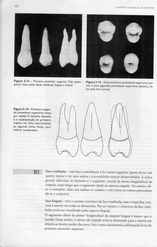 ANATOMIA INDIVIDUAL DOS DENTES
Figura 2-12 - Primeiro premolar superior. Três exem-
plares vistos pelas faces vestibular, lingual e mesial.
Figura 2-13- Dois primeiros premolares superiores (aci-
ma) e dois segundos premolares superiores (abaixo), vis-
tos pela face oclusal.
Figura 2-14- Primeiro e segun-
do premolares superiores vistos
por mesial. O terceiro desenho
é a superposição do primeiro
(réplica em linha interrompida)
ao segundo (linha cheia), para
melhor comparação.
g9 Face vestibular - esta face ésemelhante à do canino superior, apesar deser um
quarto menor e ter seus sulcos e convexidades menos desenvolvidos. A única
grande diferença no formato é o segmento mesial da aresta longitudinal da
cúspide, mais longo que o segmento distai da mesma cúspide. No canino, dá-
se o contrário. Aliás, em ambos os caninos e em todos os outros premolares
dá-se o contrário.
Face lingual - tem o mesmo contorno da face vestibular, mas é mais lisa, con-
vexa e menor em todas as dimensões. Por ser menor, o contorno da face vesti-
bular pode ser visualizado pelo aspecto lingual.
O segmento distai da aresta* longitudinal da cúspide lingual é maior que o
mesial. Desse modo, o vértice da cúspide acha-se deslocado para a mesial em
relação ao ponto médio da coroa. Esta é uma característica diferencialforte do
primeiro premolar superior.
 