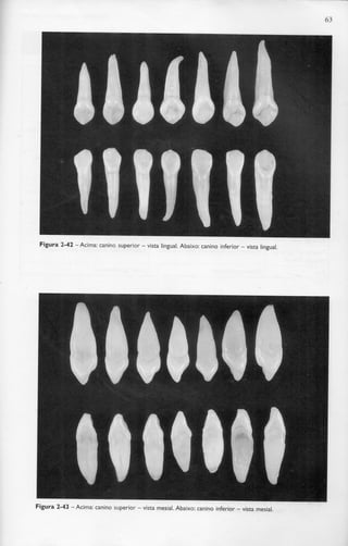 63
Figura 2-42 -Acima: canino superior - vista lingual. Abaixo: canino inferior - vista lingual.
Figura 2-43 -Acima: canino superior - vista mesial. Abaixo: canino inferior - vista mesial.
 