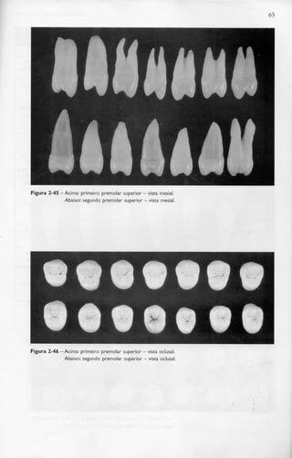 65
Figura 2-45 -Acima: primeiro premolar superior - vista mesial.
Abaixo: segundo premolar superior - vista mesial.
Figura 2-46 -Acima: primeiro premolar superior - vista oclusal.
Abaixo: segundo premolar superior - vista oclusal.
 