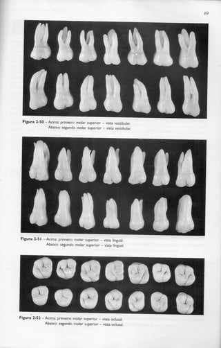 69
Figura 2-50 -Acima: primeiro molar superior - vista vestibular.
Abaixo: segundo molar superior - vistavestibular.
Figura 2-51 - Acima: primeiro molar superior - vista lingual.
Abaixo: segundo molar superior - vista lingual.
Figura 2-52 - Acima: primeiro molar superior - vista oclusal.
Abaixo: segundo molar superior - vista oclusal.
 