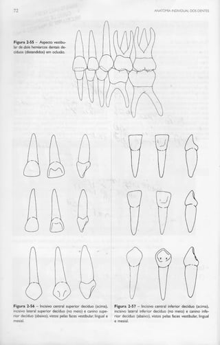 ANATOMIA INDIVIDUAL DOS DENTES
Figura 2-55 - Aspecto vestibu-
lar de dois hemiarcos dentais de-
cíduos (distendidos) em oclusão.
Figura 2-56 - Incisivo central superior decíduo (acima),
incisivo lateral superior decíduo (no meio) e canino supe-
rior decíduo (abaixo), vistos pelas faces vestibular, lingual e
mesial.
Figura 2-57 - Incisivo central inferior decíduo (acima),
incisivo lateral inferior decíduo (no meio) e canino infe-
rior decíduo (abaixo), vistos pelas faces vestibular, lingual
e mesial.
 