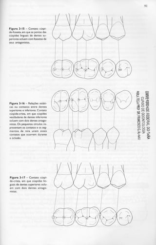 91
Figura 3-15 - Contato cúspi-
de-fosseta, em que as pontas das
cúspides linguais de dentes su-
periores ocluem com fossetas de
seus antagonistas.
Figura 3-16 - Relações estáti-
cas ou contatos entre dentes
superiores e inferiores. Contato
cúspide-crista, em que cúspides
vestibulares de dentes inferiores
ocluem com dois dentes antago-
nistas. Os pequenos círculos re-
presentam os contatos e os seg-
mentos de reta unem esses
contatos que ocorrem durante
a oclusão.
Figura 3-17 - Contato cúspi-
de-crista, em que cúspides lin-
guais de dentes superiores oclu-
em com dois dentes antago-
nistas.
 