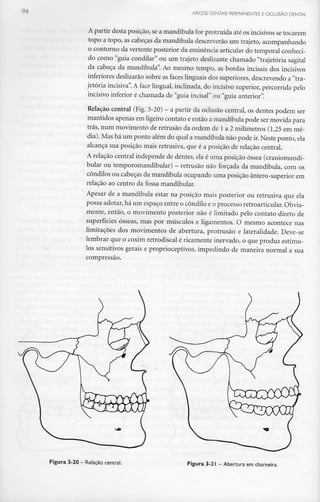 --. ARCOS DENTAIS PERMANENTES E OCLUSÃO DENTAL
A partir desta posição, se a mandíbula for protruída até os incisivos se tocarem
topo a topo, as cabeças da mandíbula descreverão um trajeto, acompanhando
o contorno da vertente posterior da eminência articular do temporal conheci-
do como "guia condilar" ou um trajeto deslizante chamado "trajetória sagital
da cabeça da mandíbula". Ao mesmo tempo, as bordas incisais dos incisivos
inferiores deslizarãosobre as faces linguais dos superiores, descrevendo a "tra-
jetória incisiva".A face lingual, inclinada, do incisivo superior,percorrida pelo
incisivo inferior é chamada de "guia incisai" ou "guia anterior".
Relação central (Fig. 3-20) - a partir da oclusão central, os dentes podem ser
mantidos apenas em ligeiro contato e então a mandíbula pode ser movida para
trás, num movimento de retrusao da ordem de l a 2 milímetros (1,25 em mé-
dia). Mashá um ponto além do qual a mandíbula não pode ir.Neste ponto,ela
alcança sua posição mais retrusiva, que é a posição de relação central.
A relação central independe de dentes, ela é uma posição óssea (craniomandi-
bular ou temporomandibular) - retrusao não forçada da mandíbula, comos
côndilos ou cabeçasda mandíbula ocupando uma posição ântero-superior em
relação ao centro da fossa mandibular.
Apesar de a mandíbula estar na posição mais posterior ou retrusiva que ela
possa adotar, há um espaço entre o côndilo e o processo retroarticular. Obvia-
mente, então, o movimento posterior não é limitado pelo contato direto de
superfícies ósseas, mas por músculos e ligamentos. O mesmo acontece nas
limitações dos movimentos de abertura, protrusão e lateralidade. Deve-se
lembrar que o coxim retrodiscal é ricamente inervado, o que produz estímu-
los sensitivos gerais e proprioceptivos, impedindo de maneira normal a sua
compressão.
Figura 3-20 - Relação central. Figura 3-21 - Abertura em charneira.
 