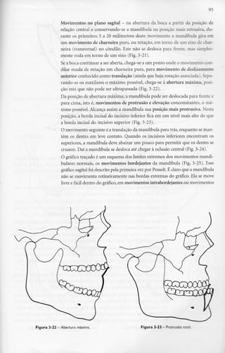 95
Movimentos no plano sagital - na abertura da boca a partir da posição de
relação central e conservando-se a mandíbula na posição mais retrusiva, du-
rante os primeiros 5 a 20 milímetros deste movimento a mandíbula gira em
um movimento de charneira puro, ou rotação, em torno de um eixo de char-
neira (transversal) no côndilo. Este não se desloca para frente, mas simples-
mente roda em torno de um eixo (Fig.3-21).
Se a boca continuar a ser aberta,chega-se a um ponto onde o movimento con-
dilar muda de rotação em charneira pura, para movimento de deslizamento
anterior conhecido como translação (ainda que haja rotação associada;. Sepa-
rando-se os maxilares o máximo possível, chega-se à abertura máxima, posi-
ção esta que não pode ser ultrapassada (Fig. 3-22).
Da posição de abertura máxima, a mandíbula pode ser deslocada para frente e
para cima, isto é, movimentos de protrusão e elevação concomitantes, o má-
ximo possível.Alcança assim a mandíbula sua posição mais protrusiva. Nesta
posição, a borda incisai do incisivo inferior fica em um nível mais alto do que
a borda incisai do incisivo superior (Fig.3-23).
O movimento seguinte é a translação da mandíbula para trás, enquanto se man-
tém os dentes em leve contato. Quando os incisivos inferiores encontram os
superiores, a mandíbula deve abaixar um pouco para permitir que os dentes se
cruzem. Daí a mandíbula se desloca até chegar à oclusão central (Fig.3-24).
O gráfico traçado é um esquema dos limites extremos dos movimentos mandi-
bulares normais, os movimentos bordejantes da mandíbula (Fig. 3-25). Esse
gráfico sagitalfoi descrito pela primeira vezpor Posselt. É claro que a mandíbula
não se movimenta rotineiramente nas bordas extremas do gráfico. Ela se move
livre e fácil dentro do gráfico, em movimentos intrabordejantes ou movimentos
Figura 3-22 —Abertura máxima. Figura 3-23 - Protrusão total.
 