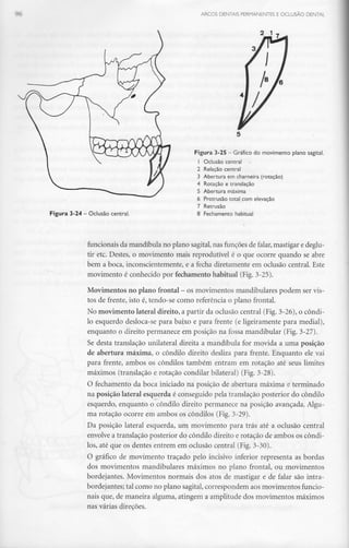 96 ARCOS DENTAIS PERMANENTES E OCLUSÃO DENTAL
2 1
Figura 3-25 —Gráfico do movimento plano sagital.
1 Oclusão central
2 Relação central
3 Abertura em charneira (rotação)
4 Rotação e translação
5 Abertura máxima
6 Protrusão total com elevação
Figura 3-24 - Oclusão central.
Retrusão
Fechamento habitual
funcionais da mandíbula no plano sagital, nas funções de falar, mastigar e deglu-
tir etc. Destes, o movimento mais reprodutível é o que ocorre quando se abre
bem a boca, inconscientemente, e a fecha diretamente em oclusão central. Este
movimento é conhecido por fechamento habitual (Fig.3-25).
Movimentos no plano frontal - osmovimentos mandibulares podem servis-
tos de frente, isto é, tendo-se como referência o plano frontal.
No movimento lateral direito, a partir da oclusão central (Fig.3-26), o condi-
lo esquerdo desloca-se para baixo e para frente (e ligeiramente para medial),
enquanto o direito permanece em posição na fossa mandibular (Fig. 3-27).
Se desta translação unilateral direita a mandíbula for movida a uma posição
de abertura máxima, o côndilo direito desliza para frente. Enquanto ele vai
para frente, ambos os côndilos também entram em rotação até seus limites
máximos (translação e rotação condilar bilateral) (Fig. 3-28).
O fechamento da boca iniciado na posição de abertura máxima e terminado
na posição lateral esquerda é conseguido pela translação posterior do côndilo
esquerdo, enquanto o côndilo direito permanece na posição avançada. Algu-
ma rotação ocorre em ambos os côndilos (Fig. 3-29).
Da posição lateral esquerda, um movimento para trás até a oclusão central
envolve a translação posterior do côndilo direito e rotação de ambos os côndi-
los, até que os dentes entrem em oclusão central (Fig.3-30).
O gráfico de movimento traçado pelo incisivo inferior representa as bordas
dos movimentos mandibulares máximos no plano frontal, ou movimentos
bordejantes. Movimentos normais dos atos de mastigar e de falar são intra-
bordejantes; tal como no plano sagital,correspondem aos movimentos funcio-
nais que, de maneira alguma, atingem a amplitude dos movimentos máximos
nas várias direções.
 