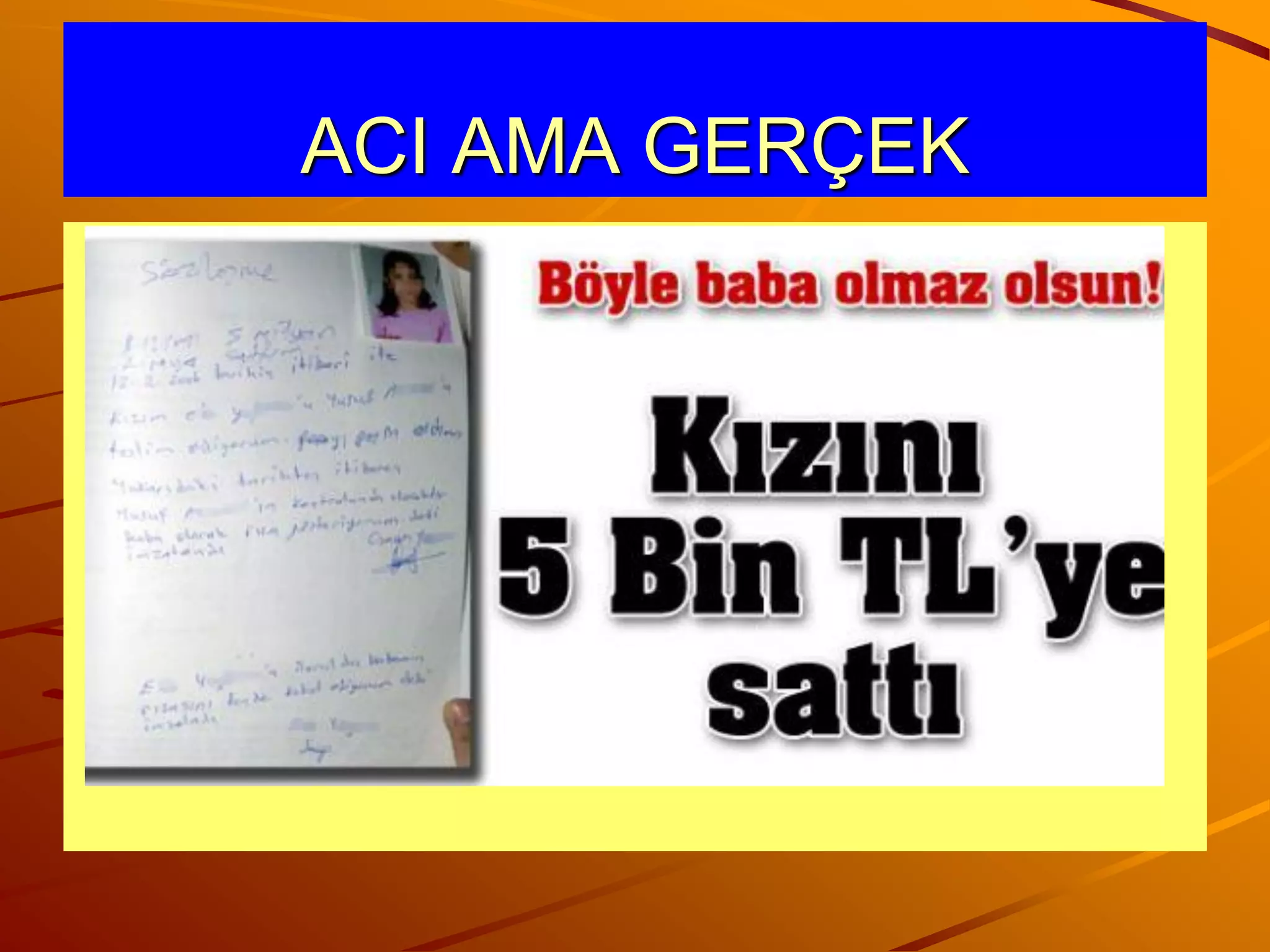 ACI AMA GERÇEK
 