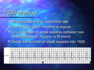 Rhythym Calculation Using 1500 Method ECG Workshop | PPT
