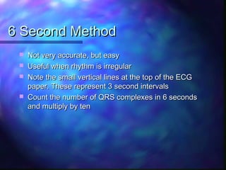 ECG Workshop | PPT