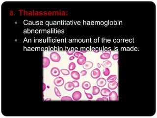 8. Thalassemia:
   Cause quantitative haemoglobin
    abnormalities
   An insufficient amount of the correct
    haemoglobin type molecules is made.
 