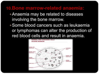 10.Bone marrow-related anaemia:
  Anaemia may be related to diseases
   involving the bone marrow.
  Some blood cancers such as leukaemia
   or lymphomas can alter the production of
   red blood cells and result in anaemia.
 