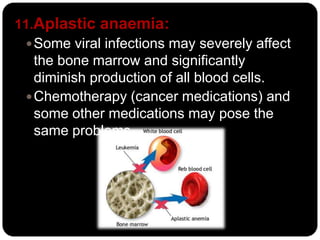 11.Aplastic anaemia:
  Some viral infections may severely affect
   the bone marrow and significantly
   diminish production of all blood cells.
  Chemotherapy (cancer medications) and
   some other medications may pose the
   same problems.
 