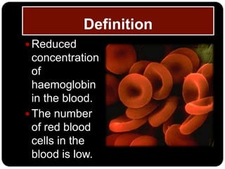 Definition
 Reduced
  concentration
  of
  haemoglobin
  in the blood.
 The number
  of red blood
  cells in the
  blood is low.
 