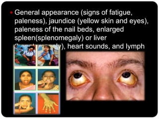  General appearance (signs of fatigue,
 paleness), jaundice (yellow skin and eyes),
 paleness of the nail beds, enlarged
 spleen(splenomegaly) or liver
 (hepatomegaly), heart sounds, and lymph
 nodes.
 