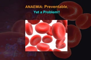 ANAEMIA: Preventable,
Yet a Problem!!

 