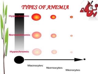 TYPES OF ANEMIA
 