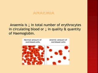 Anaemia is ↓ in total number of erythrocytes
in circulating blood or ↓ in quality & quantity
of Haemoglobin.
 