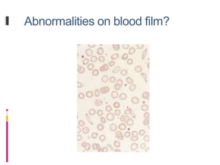 Abnormalities on blood film?
 