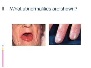 What abnormalities are shown?
 