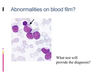 Abnormalities on blood film?
What test will
provide the diagnosis?
 