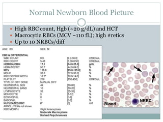 Rbc Diff Test anaemia.pptx