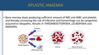 • Bone marrow stops producing sufficient amount of RBC and WBC and platelet
and thereby increasing the risk of infection and hemorrhage can be congenital,
acquired or idiopathic. Results in THROMBOCYTOPENIA ,LEUKOPENIA and
ANAEMIA.
 