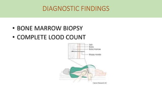• BONE MARROW BIOPSY
• COMPLETE LOOD COUNT
 