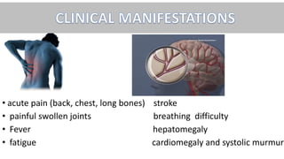 • acute pain (back, chest, long bones) stroke
• painful swollen joints breathing difficulty
• Fever hepatomegaly
• fatigue cardiomegaly and systolic murmur
 