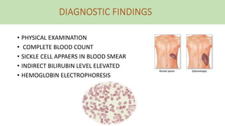 • PHYSICAL EXAMINATION
• COMPLETE BLOOD COUNT
• SICKLE CELL APPAERS IN BLOOD SMEAR
• INDIRECT BILIRUBIN LEVEL ELEVATED
• HEMOGLOBIN ELECTROPHORESIS
 