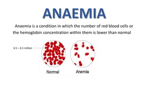 Anaemia is a condition in which the number of red blood cells or
the hemoglobin concentration within them is lower than normal
4.5 – 6.5 million
 