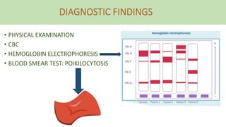 • PHYSICAL EXAMINATION
• CBC
• HEMOGLOBIN ELECTROPHORESIS
• BLOOD SMEAR TEST: POIKILOCYTOSIS
 