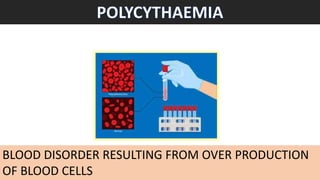 BLOOD DISORDER RESULTING FROM OVER PRODUCTION
OF BLOOD CELLS
 
