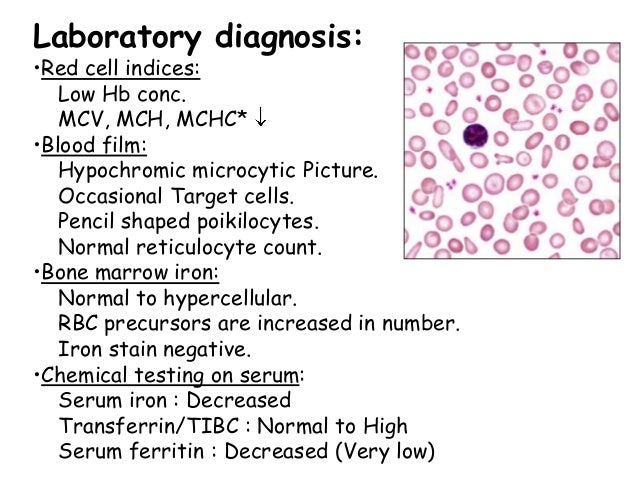 Anaemia in children