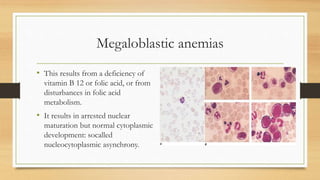 Megaloblastic anemias
• This results from a deficiency of
vitamin B 12 or folic acid, or from
disturbances in folic acid
metabolism.
• It results in arrested nuclear
maturation but normal cytoplasmic
development: socalled
nucleocytoplasmic asynchrony.
 