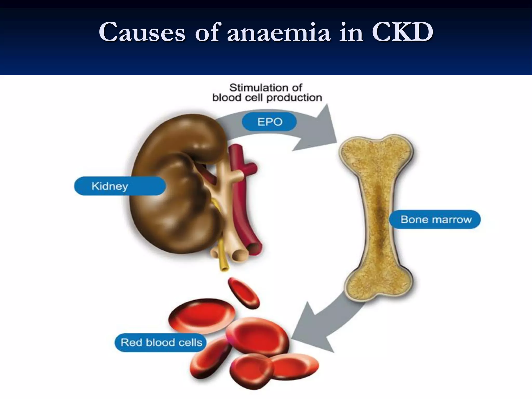 Anaemia of chronic kidney disease GUIDELINES TO PRACTICE 2013 | PDF