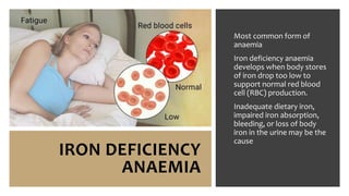 IRON DEFICIENCY
ANAEMIA
Most common form of
anaemia
Iron deficiency anaemia
develops when body stores
of iron drop too low to
support normal red blood
cell (RBC) production.
Inadequate dietary iron,
impaired iron absorption,
bleeding, or loss of body
iron in the urine may be the
cause
 
