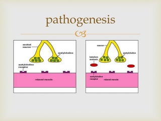 
pathogenesis
 