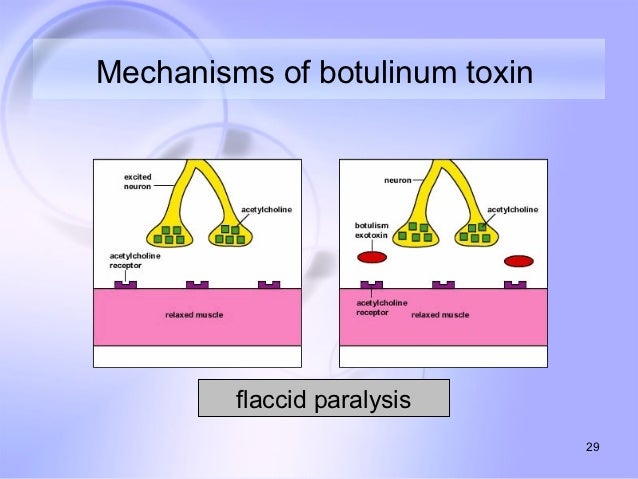 Anaerobic Bacteria In Canned Food Anaerobic Bacteria In Canned Food