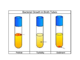 Anaerobic cultivation of bacteria class all.pptx