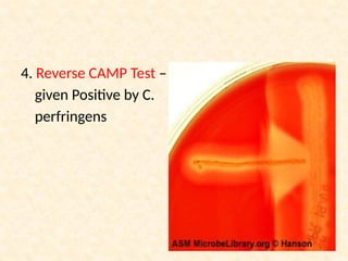 Laboratory Diagnosis of Anaerobic Infections.pptx