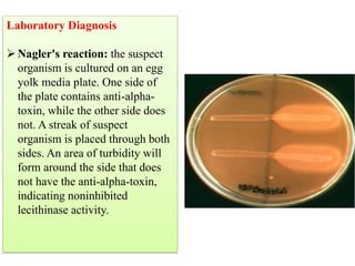 Laboratory Diagnosis
➢Nagler's reaction: the suspect
organism is cultured on an egg
yolk media plate. One side of
the plate contains anti-alpha-
toxin, while the other side does
not. A streak of suspect
organism is placed through both
sides. An area of turbidity will
form around the side that does
not have the anti-alpha-toxin,
indicating noninhibited
lecithinase activity.
explanation:
Microorganism is cultured on lecithin and divided into two
halves one has the antitoxin and the other doesn't
the half that has the antitoxin will be negative because the
antitoxin will neutralize the toxin and no reaction will occur.
the other half will appear cloudy which indicates that the
microorganism produced lecithinase and broke down the
lecithin.
 