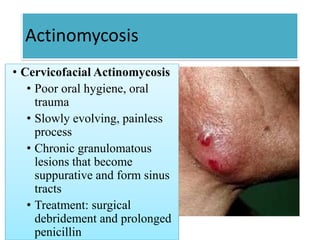 Actinomycosis
• Cervicofacial Actinomycosis
• Poor oral hygiene, oral
trauma
• Slowly evolving, painless
process
• Chronic granulomatous
lesions that become
suppurative and form sinus
tracts
• Treatment: surgical
debridement and prolonged
penicillin
 