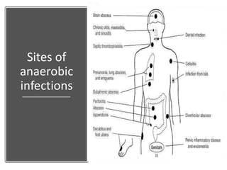 Sites of
anaerobic
infections
 