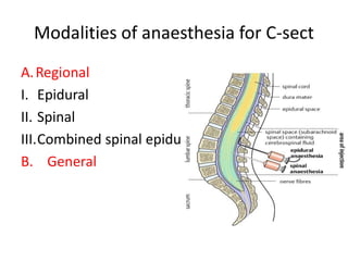 Modalities of anaesthesia for C-sect
A.Regional
I. Epidural
II. Spinal
III.Combined spinal epidural
B. General
 