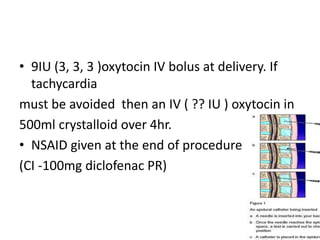 • 9IU (3, 3, 3 )oxytocin IV bolus at delivery. If
tachycardia
must be avoided then an IV ( ?? IU ) oxytocin in
500ml crystalloid over 4hr.
• NSAID given at the end of procedure -
(CI -100mg diclofenac PR)
 