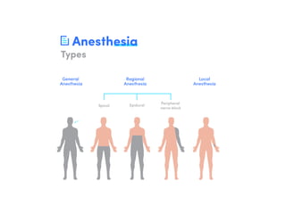 The general concept of anesthesia:- general, regional, local and ...