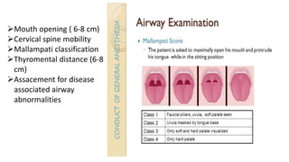 Mouth opening ( 6-8 cm)
Cervical spine mobility
Mallampati classification
Thyromental distance (6-8
cm)
Assacement for disease
associated airway
abnormalities
 