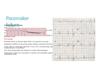 Anaesthesia considerations for patients with implantable devices.pptx