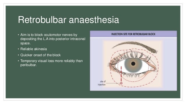 Anaesthesia for cataract surgery